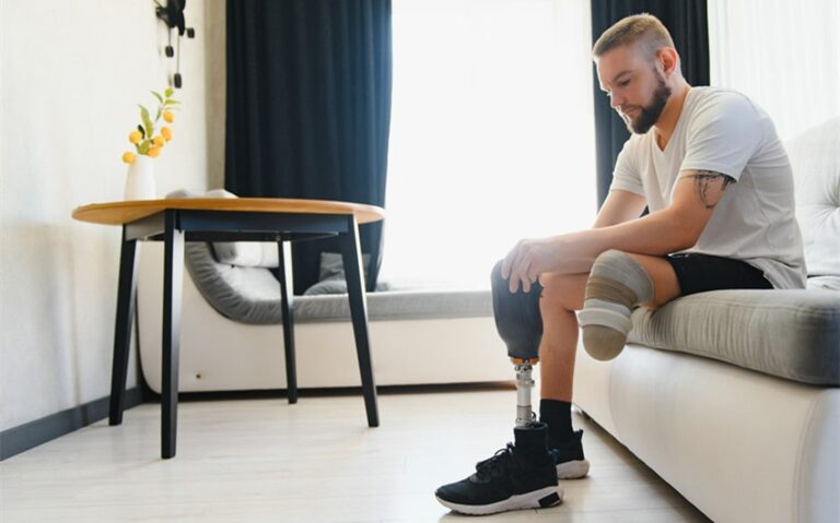 how amputation cases are valued
